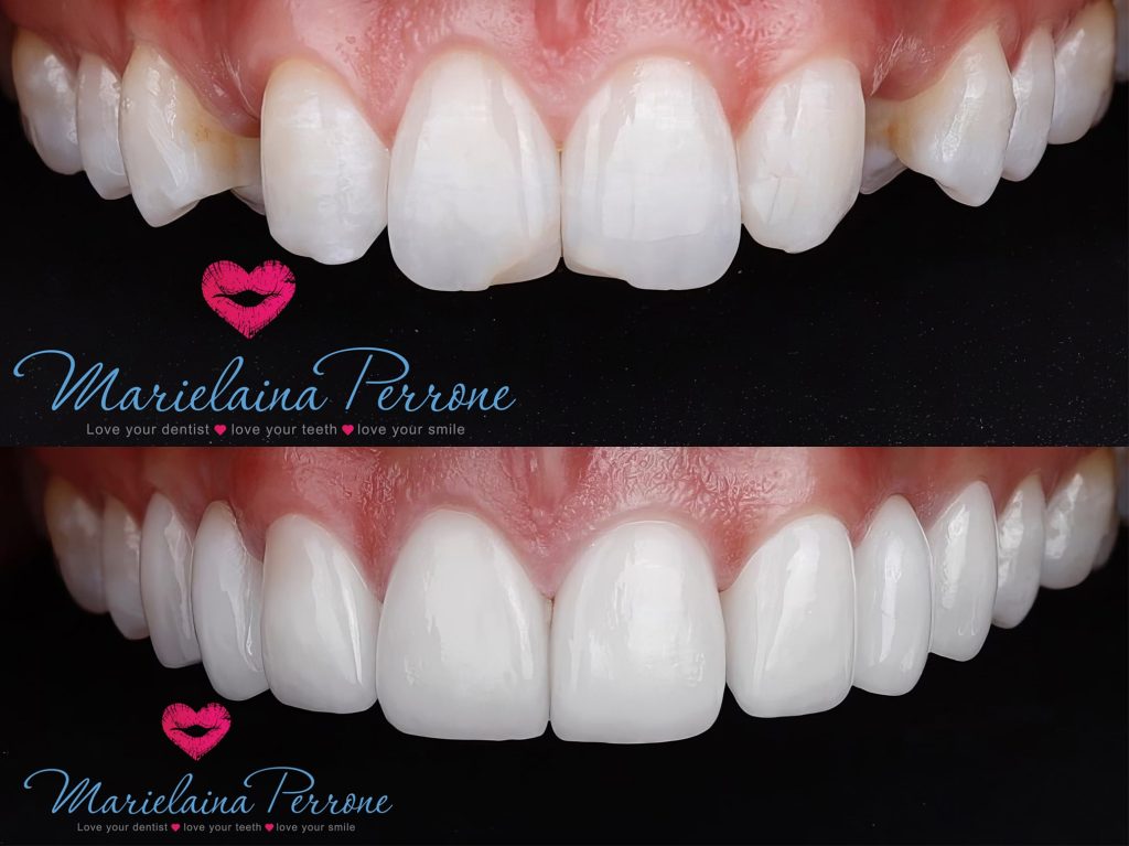 dental implants henderson nv marielaina perrone dds