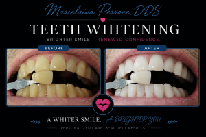 marielaina perrone dds henderson nv - teeth whitening before and after