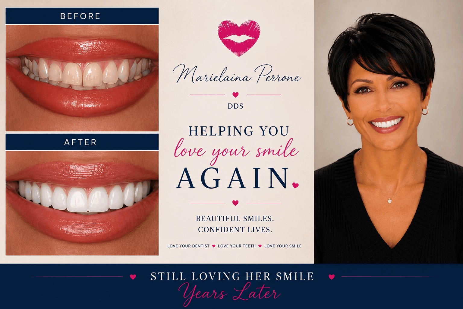 cosmetic dentistry smile makeover in henderson nv by marielaina perrone dds