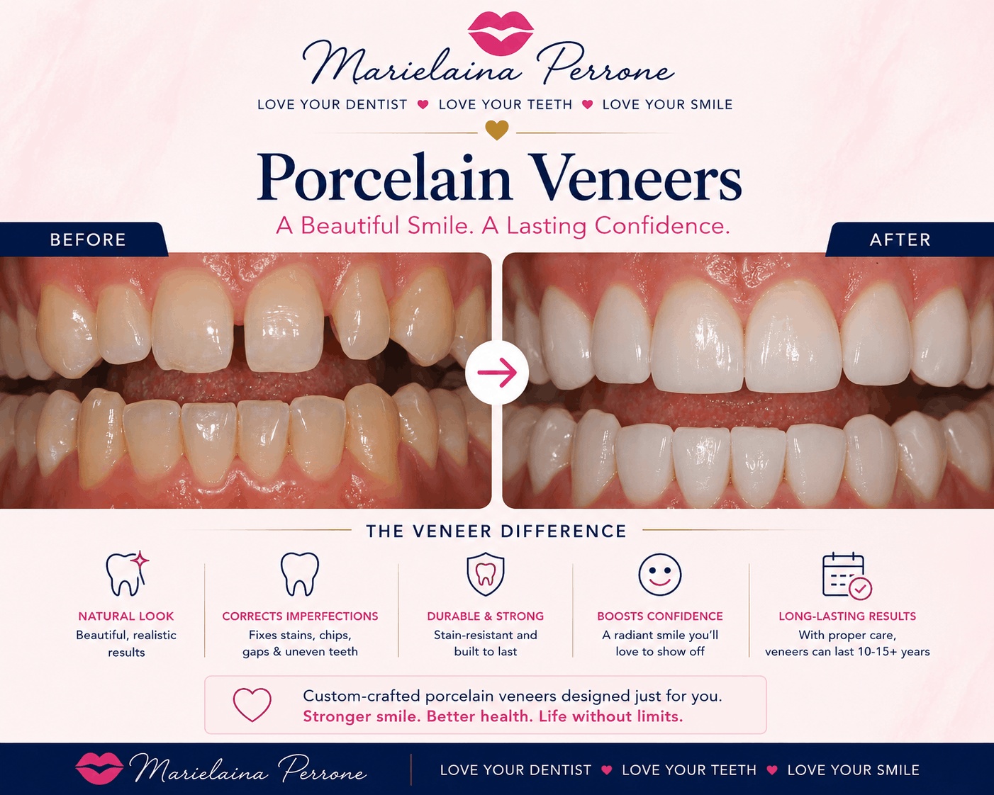 porcelain veneers in henderson nv marielaina perrone dds