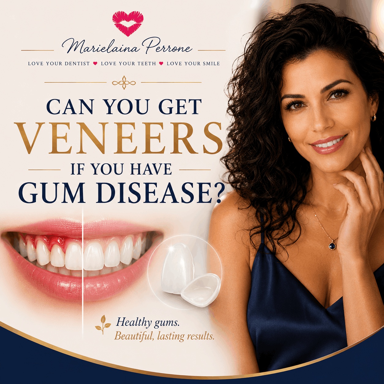 porcelain veneers in henderson nevada by marielaina perrone dds