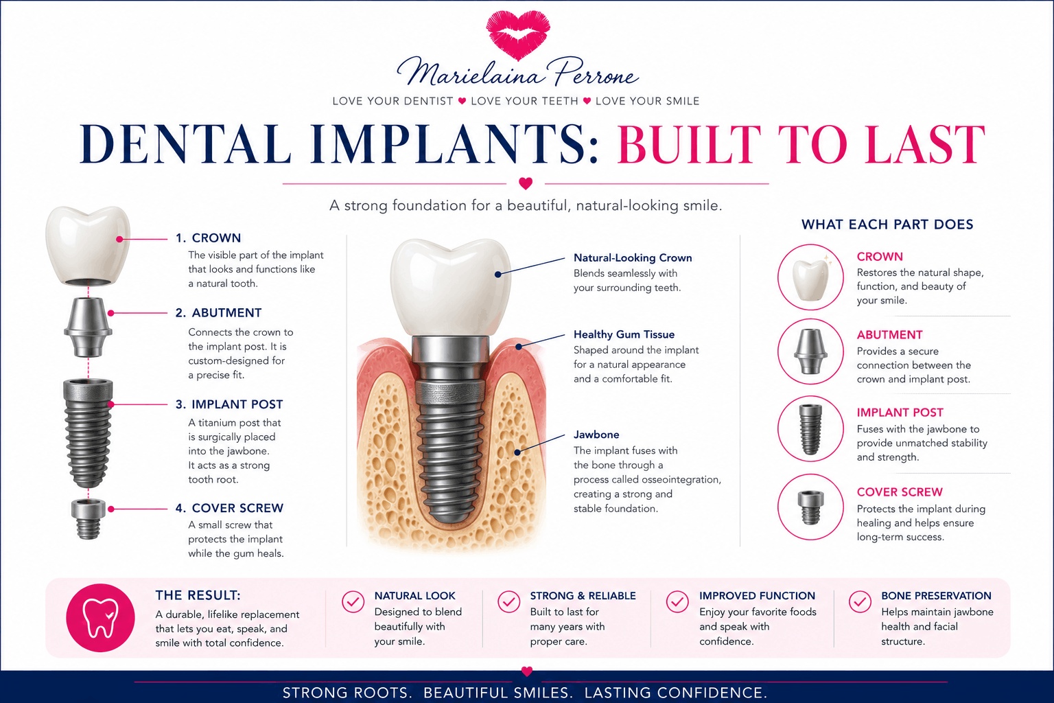 dental implants by marielaina perrone dds henderson nv dentist